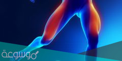 أسباب الم الساقين والفخذين وطرق علاجه