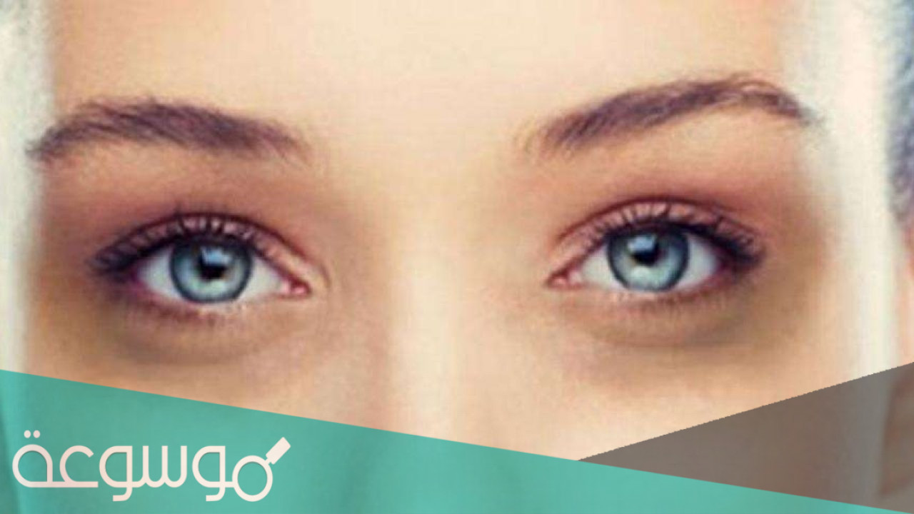 أسباب وطرق علاج السواد تحت العين