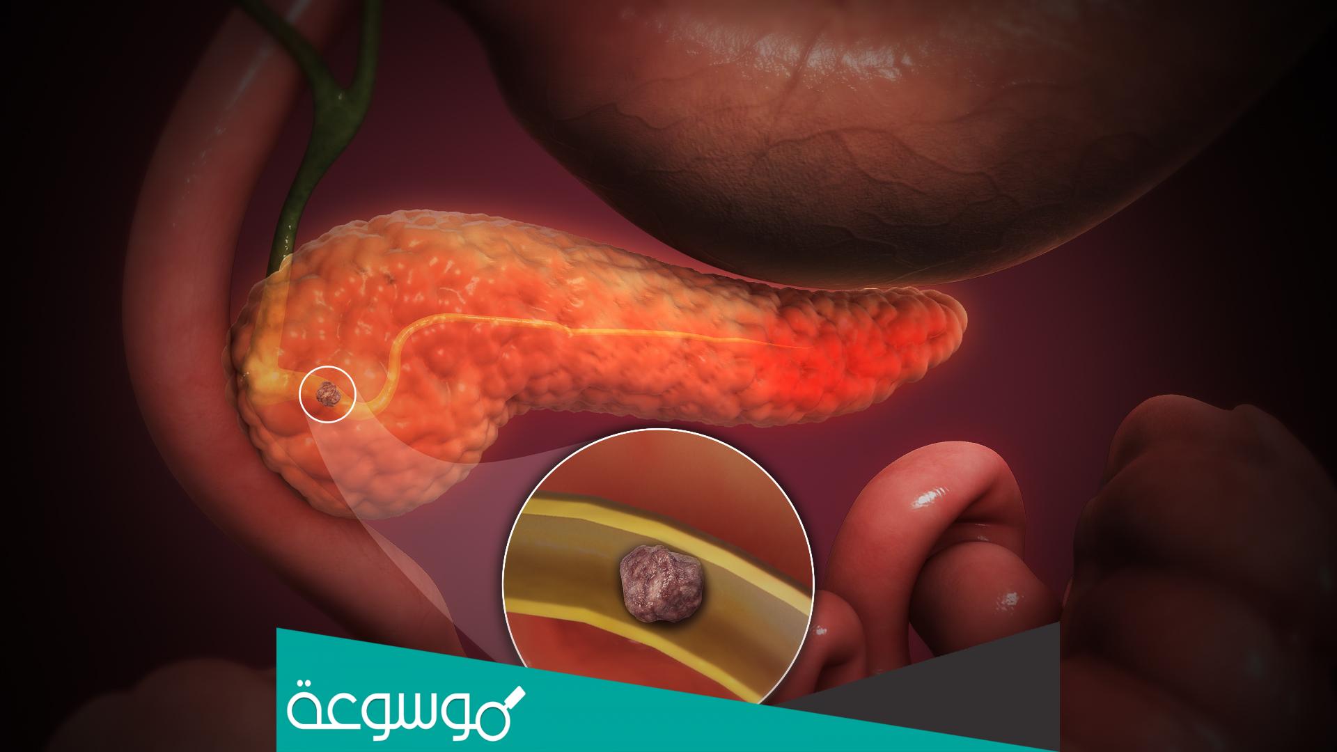 تفرز غدة البنكرياس هرمون الجلوكاجون كردة فعل لزيادة السكر