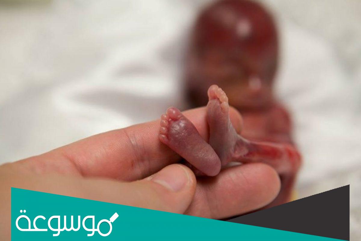 مزايا وأضرار عمليات كحت الاجهاض