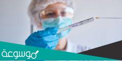 هل يكتشف اختبار PCR إصابات متحور اوميكرون