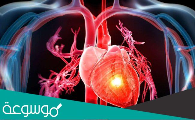 افضل دكتور قلب في جدة