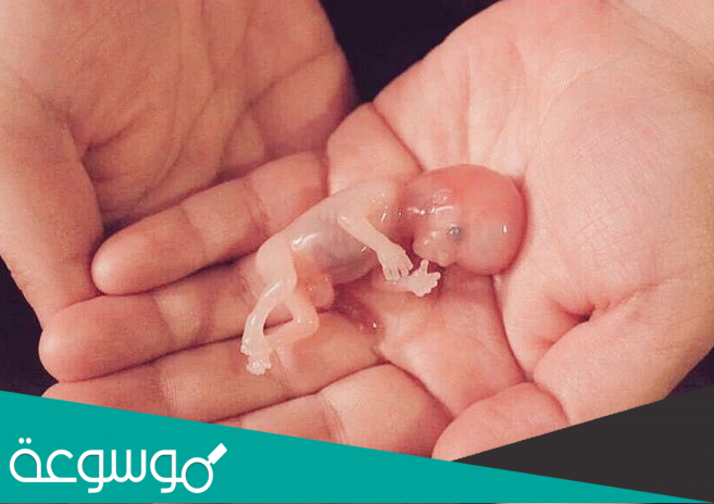 تجربتي مع الاجهاض المتعمد