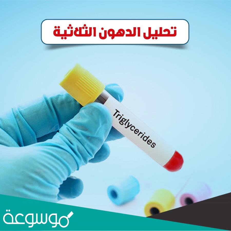 كم ساعة صيام تحليل الدهون الثلاثية