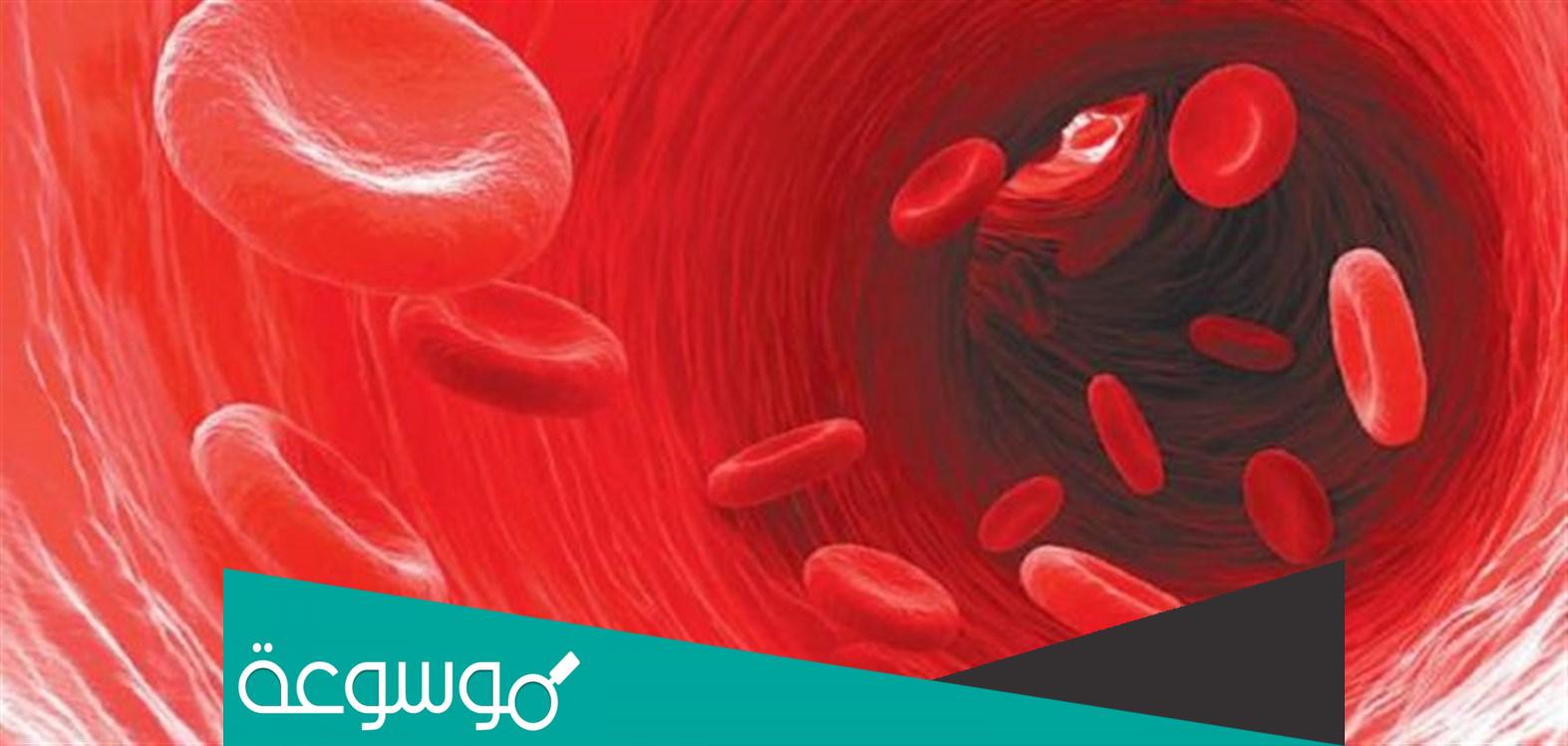 أعراض وأسباب سيولة الدم وطريقة علاجها