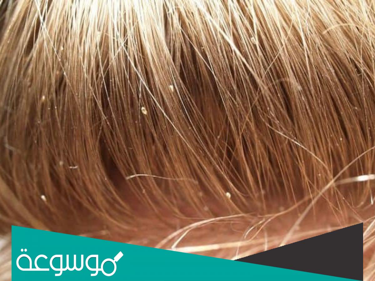 تفسير رؤية القمل في المنام حسب تفسير ابن سيرين وابن شاهين والنابلسي