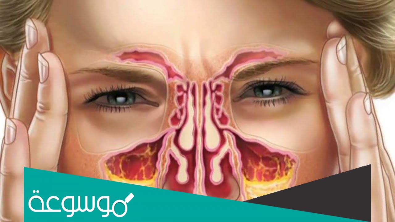 كم عدد الجيوب الانفية عند الانسان وما طرق علاجها