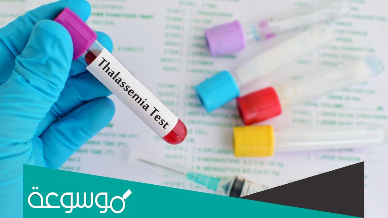 ما الفرق بين حامل الثلاسيميا والمصاب بها