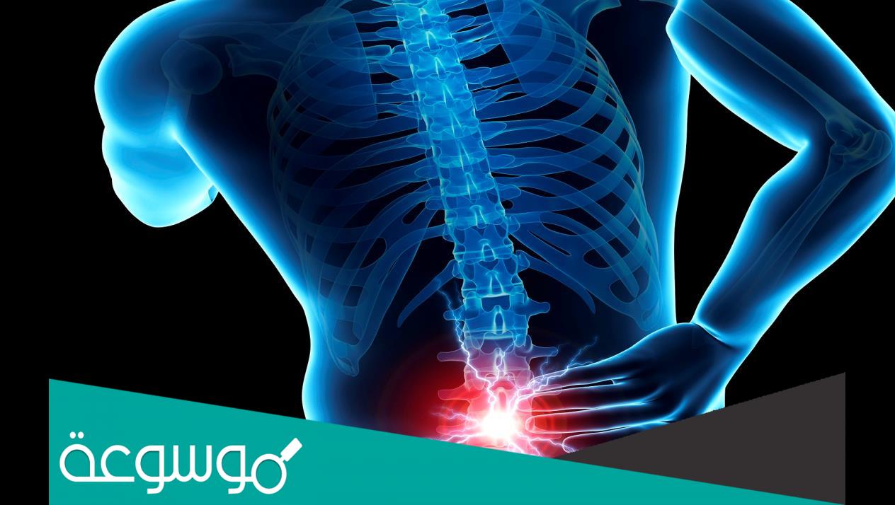كيفية تخفيف الم الديسك بطرق طبيعية