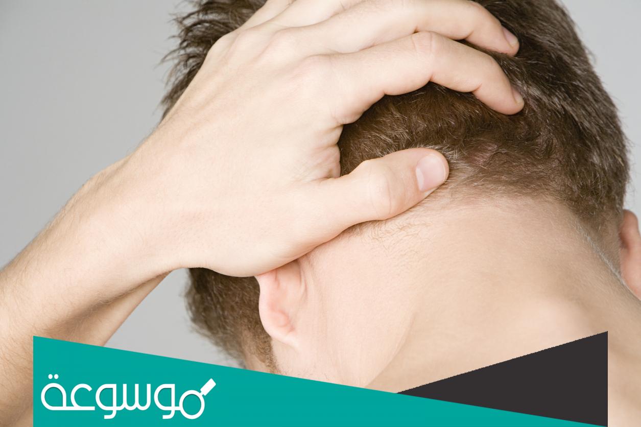 صداع خلف الرأس ما سببه وطرق علاجه الصحيحة
