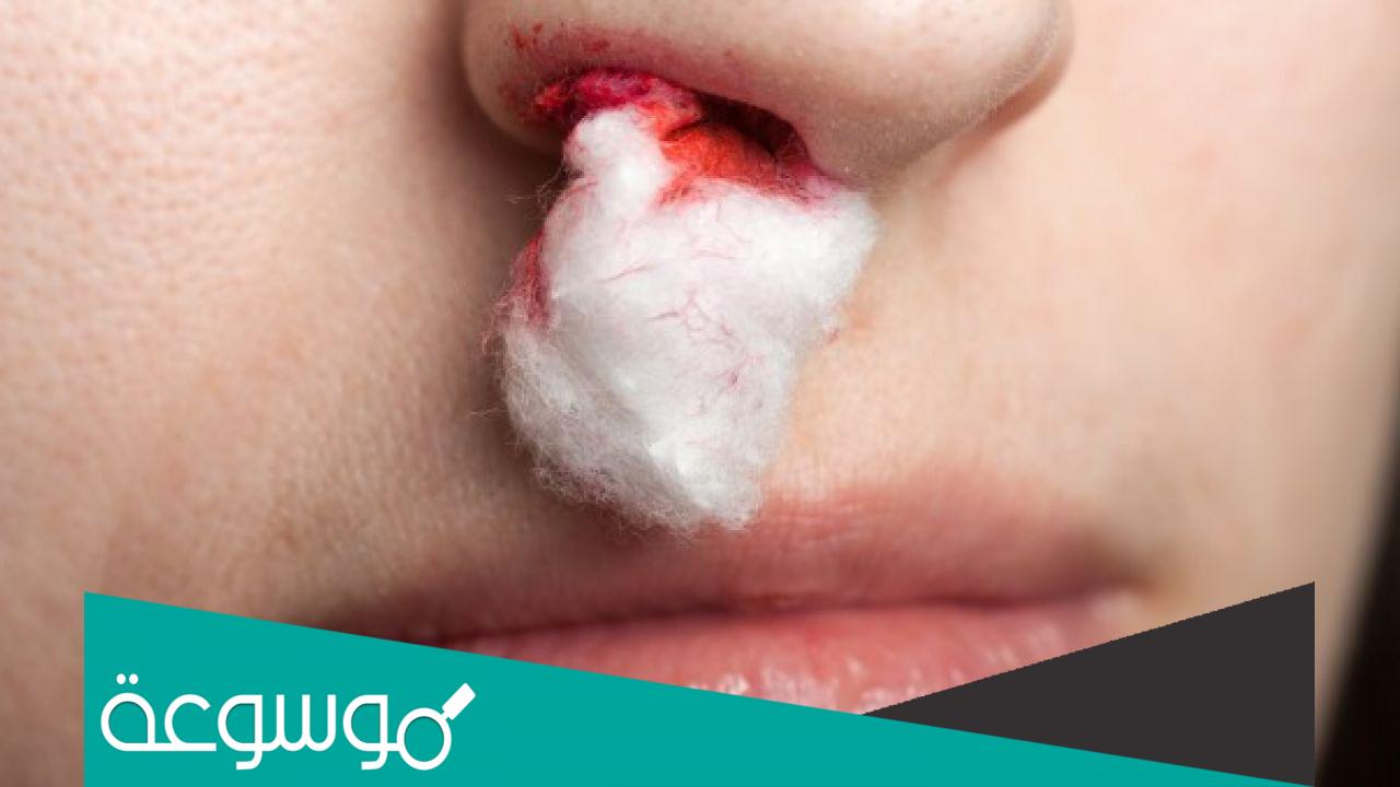 تفسير رؤية النزيف من الأنف في المنام تفسيرات مختلفة للرعاف