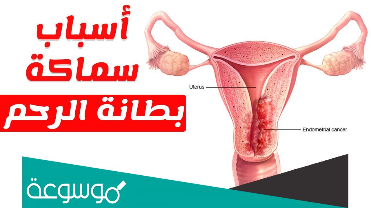 بطانة الرحم سميكة ولا يوجد كيس حمل ما السبب