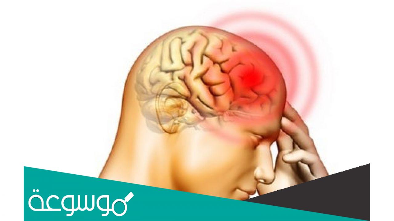 تفسير رؤية جلطة الرأس في المنام
