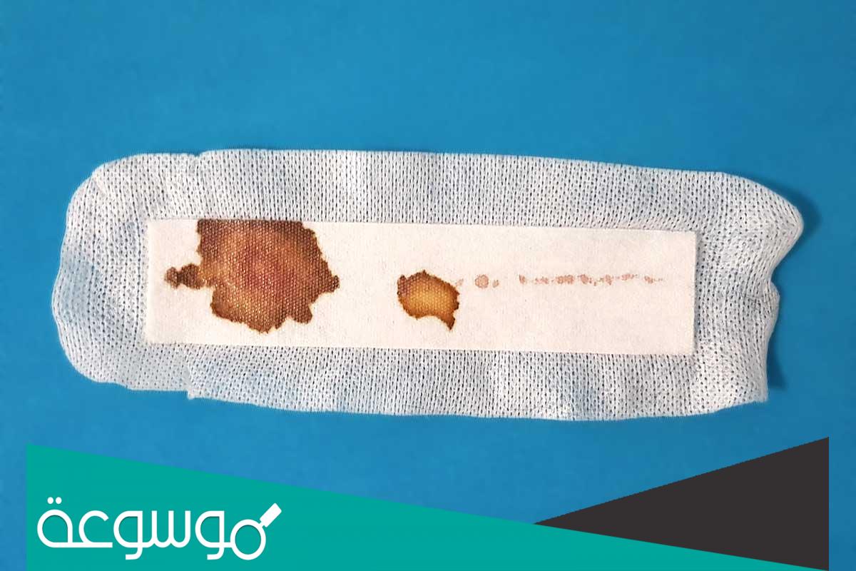 أسباب نزول إفرازات بنية من المهبل