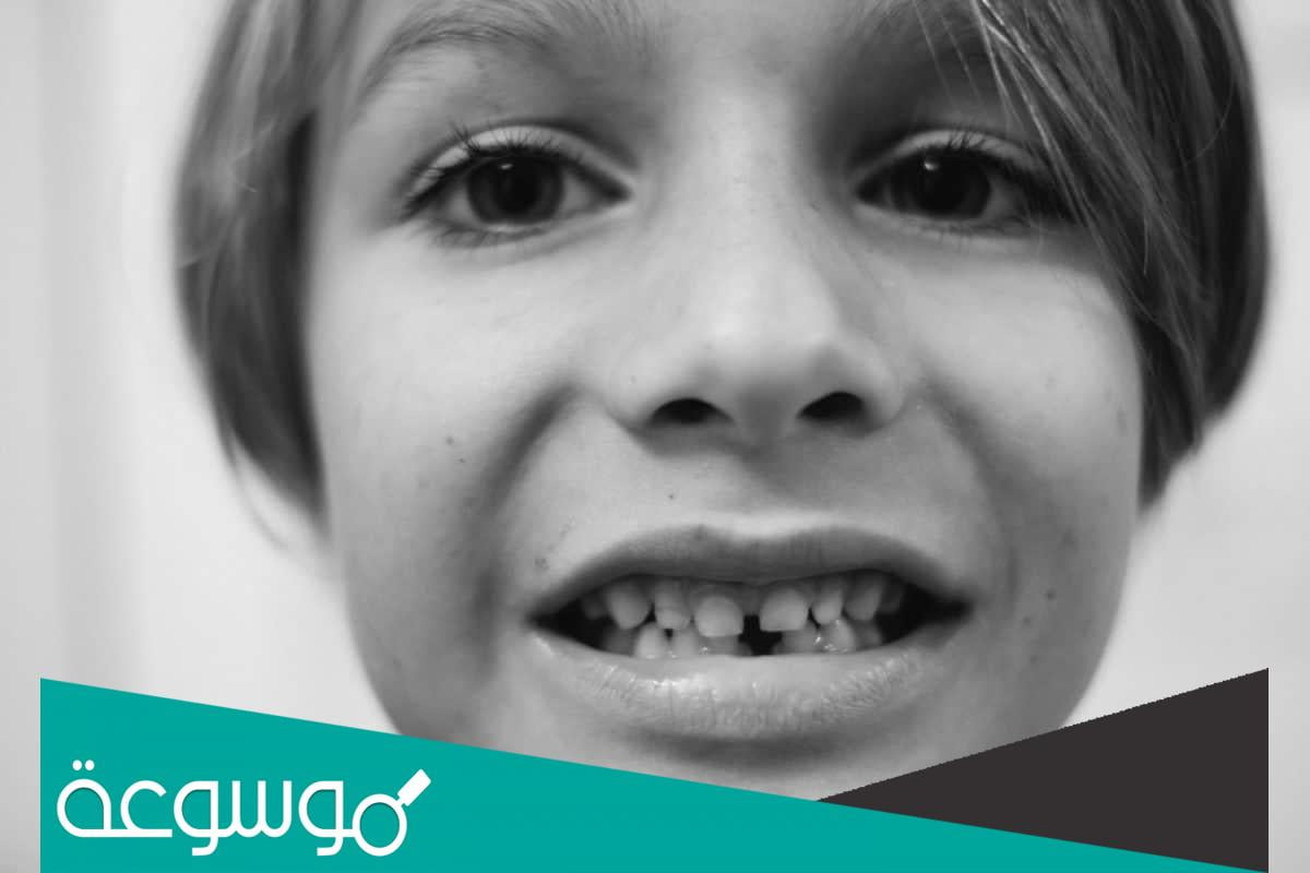 تفسير رؤية سن يقع في المنام حسب تفسير للنابلسي وابن سيرين