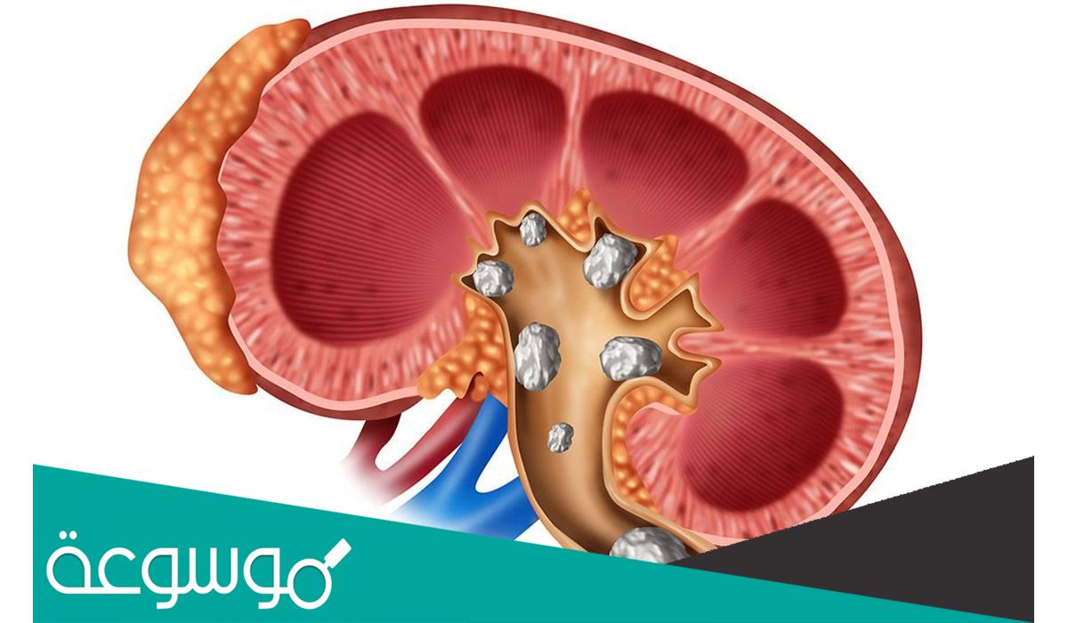 تفسير رؤية خروج الحصى مع البول حسب تفسير ابن سيرين والنابلسي وابن شاهين