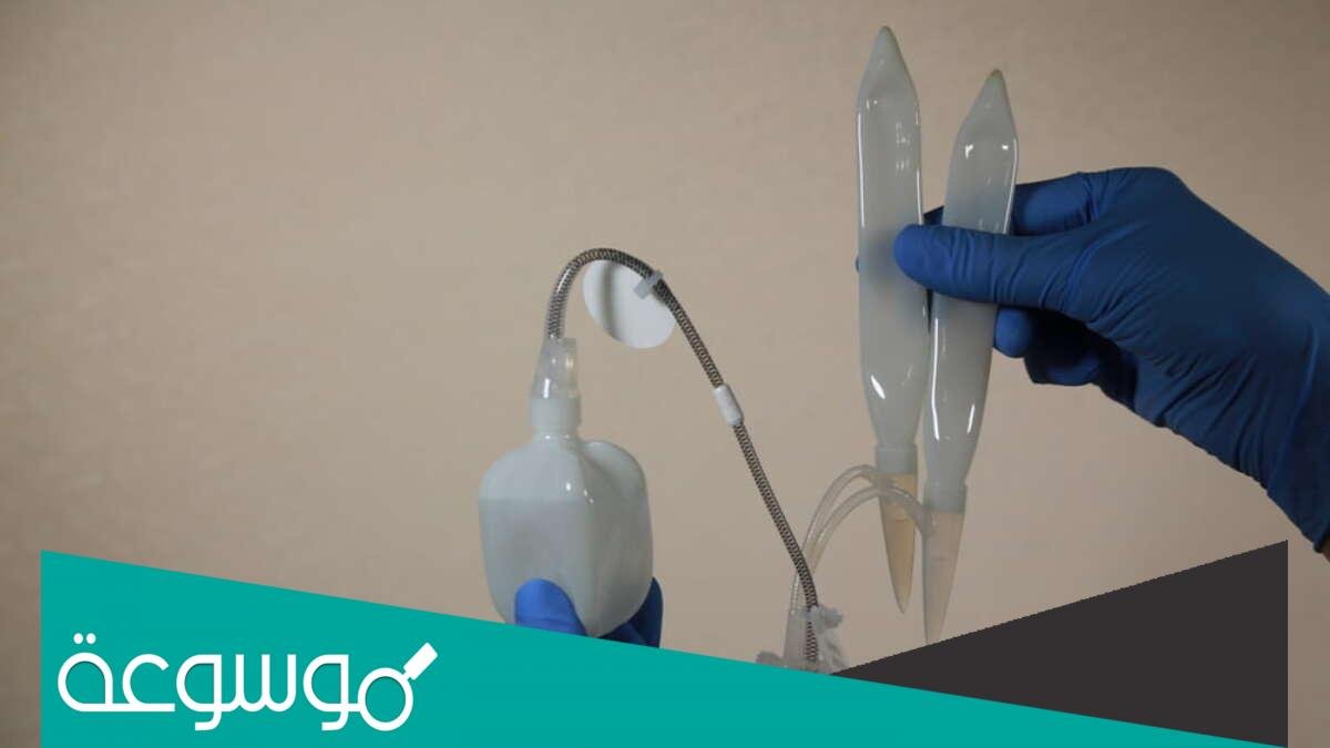 ما هو مرض بيروني ؟