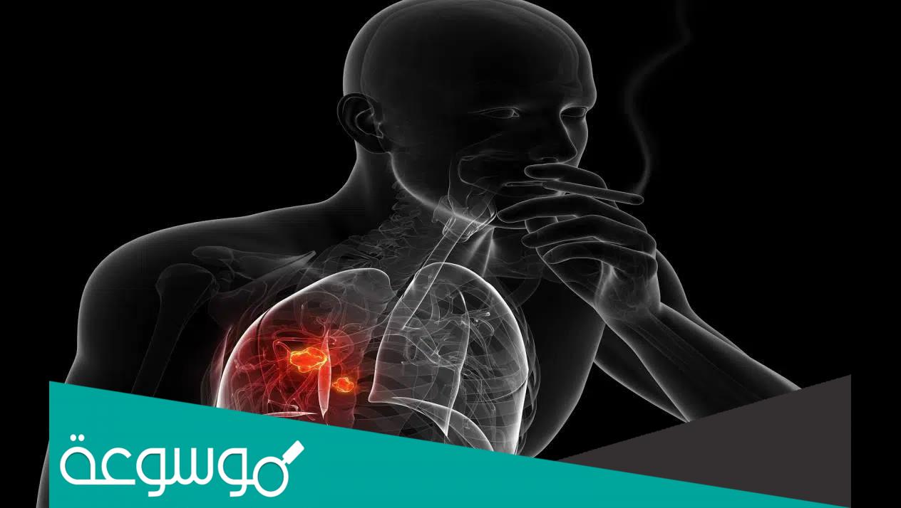 هل تعود الرئة لحالتها الطبيعية بعد الإقلاع عن التدخين
