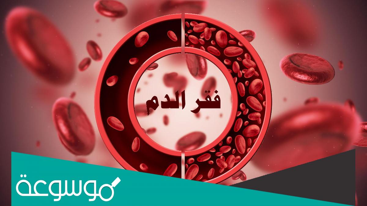 علاج فقر الدم بالغذاء بدون ادوية وعقاقير طبية