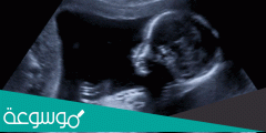 متى يظهر نبض الجنين بالسونار وما هي علامات ظهوره