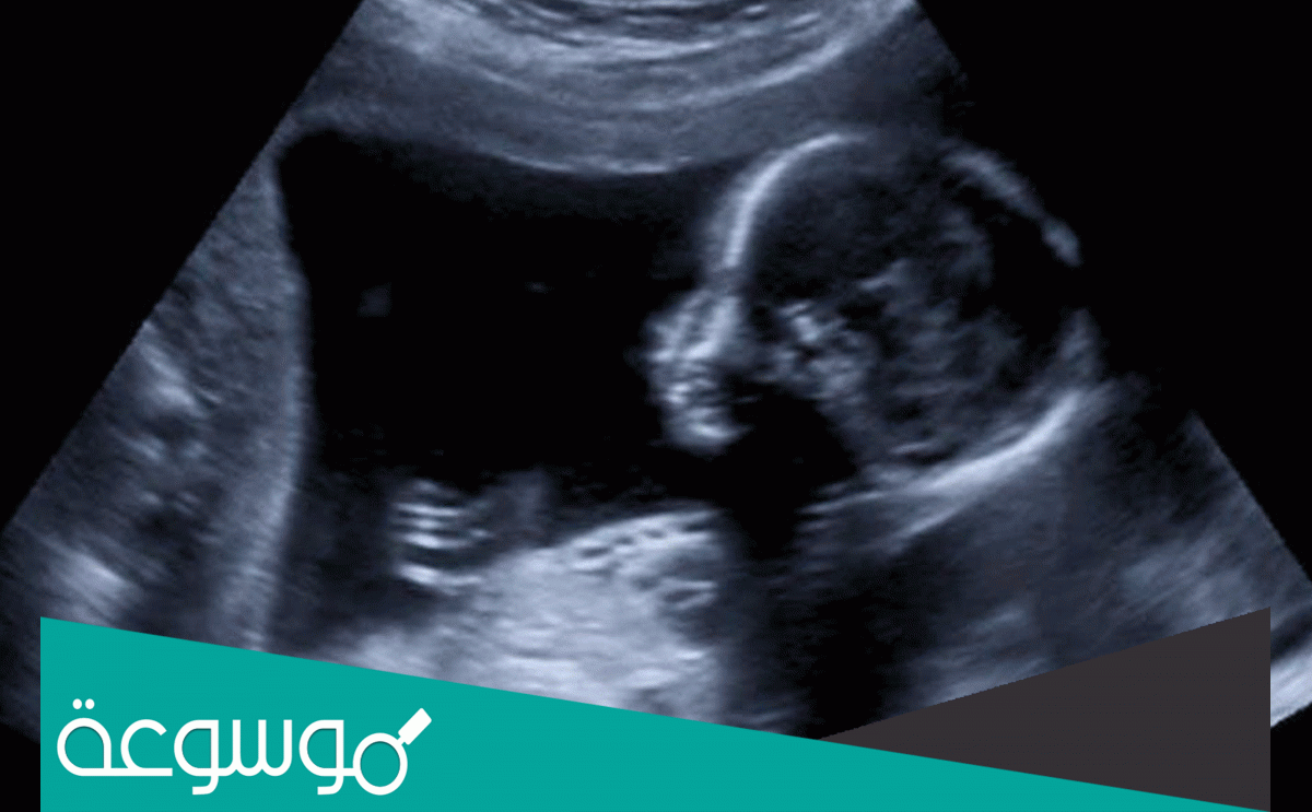 متى يظهر نبض الجنين بالسونار وما هي علامات ظهوره