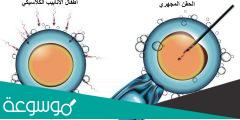 ما طريقة استخراج البويضات للحقن المجهري طبيا