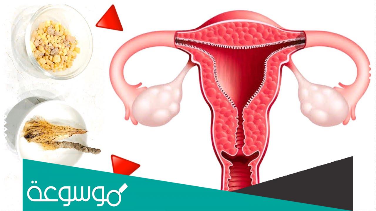 ما علاج نزيف الرحم بالأعشاب الطبيعية وأسباب النزيف