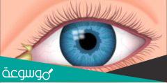 علاج افرازات العين الصفراء وأسباب هذه الإفرازات