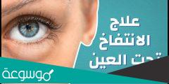 ما سبب ظهور انتفاخ تحت العين وافضل طرق العلاج لانتفاخ العين