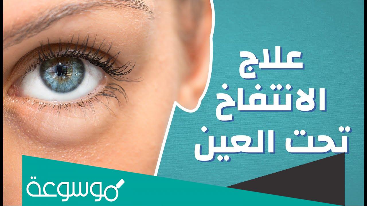 ما سبب ظهور انتفاخ تحت العين وافضل طرق العلاج لانتفاخ العين