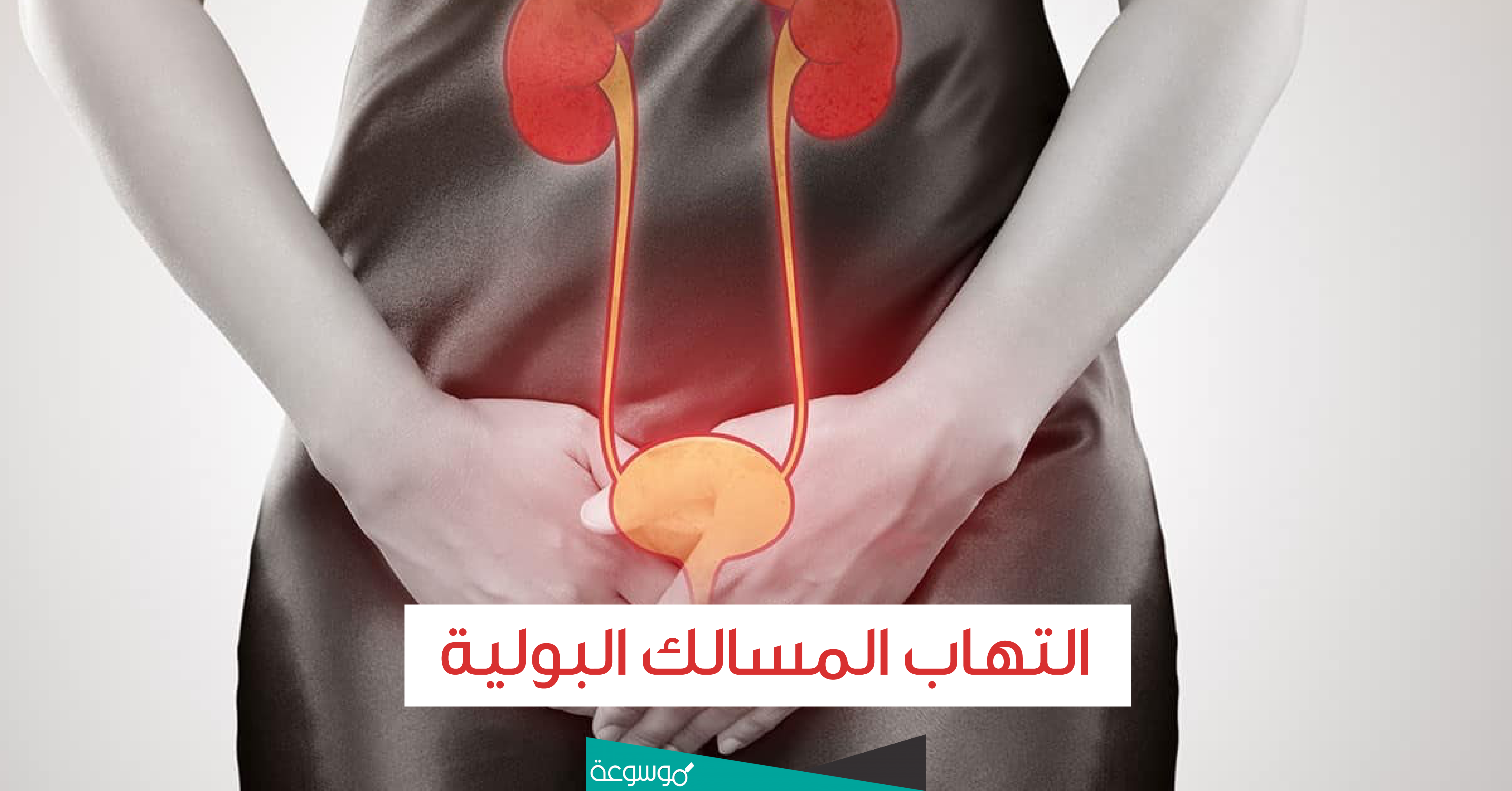 أعراض وأسباب التهاب المسالك البولية عند النساء وطرق الوقاية