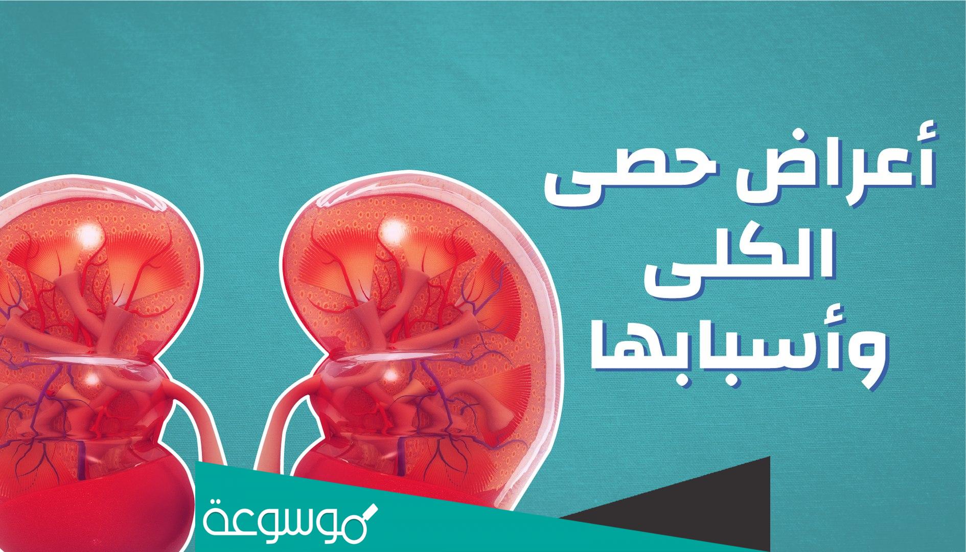 ما هي اعراض حصى الكلى واسبابها وطرق علاجها بالتفصيل