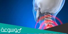 ما علاج التواء الرقبة بعد النوم وما أسباب الإلتواء