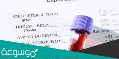 فوائد تحليل الدهون الثلاثية والكوليسترول بشكل دوري