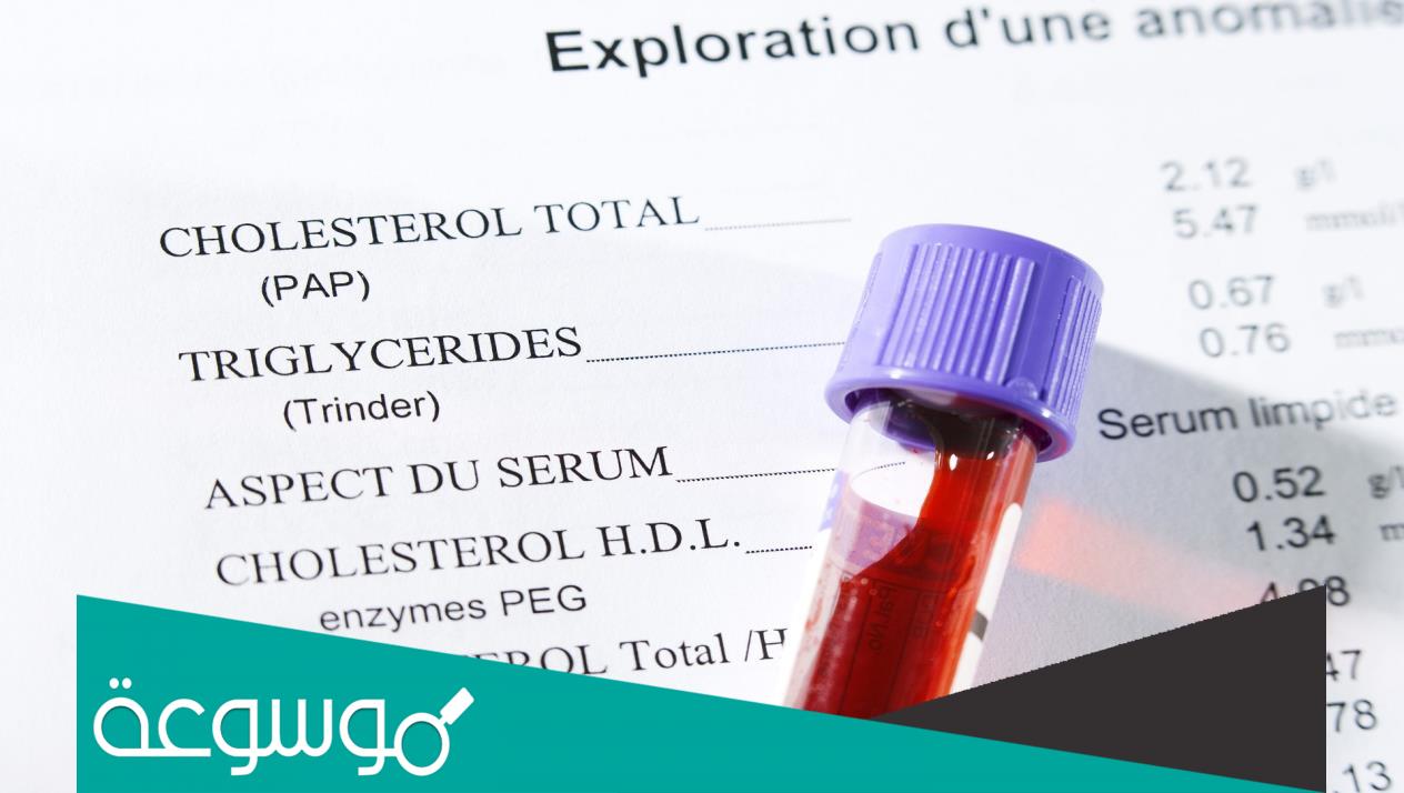 فوائد تحليل الدهون الثلاثية والكوليسترول بشكل دوري