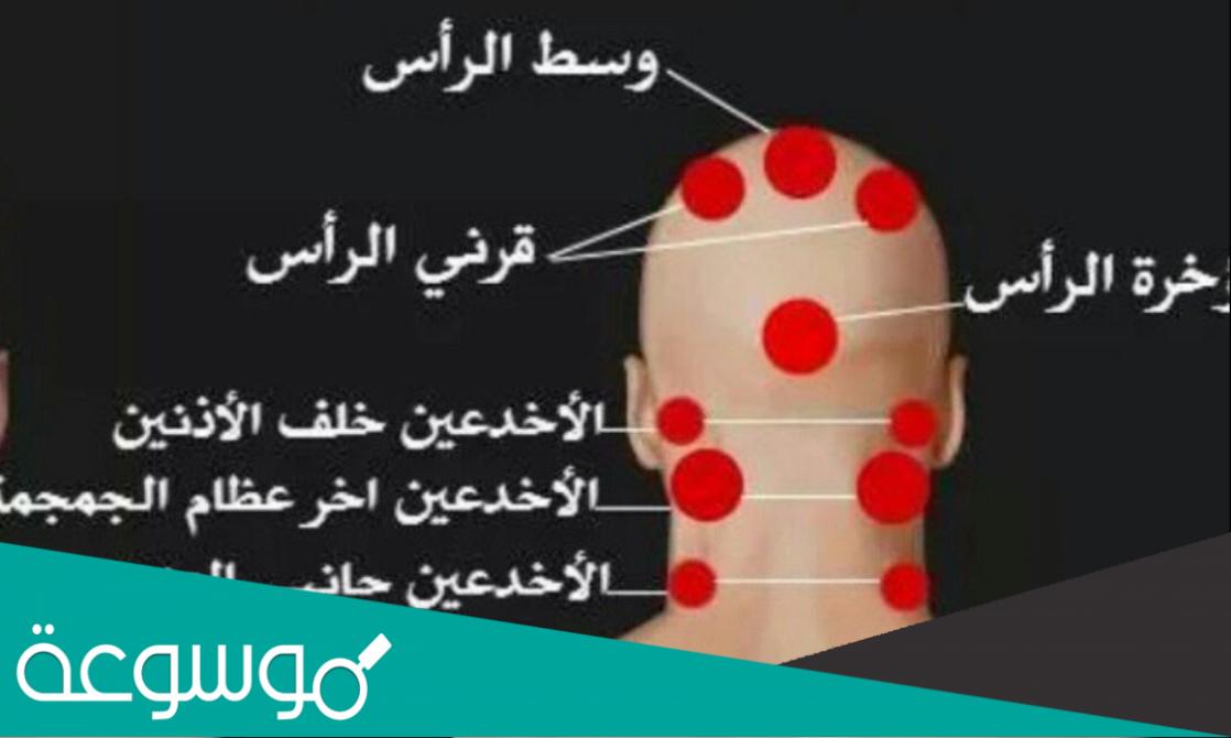 تجربتي مع حجامة الرأس