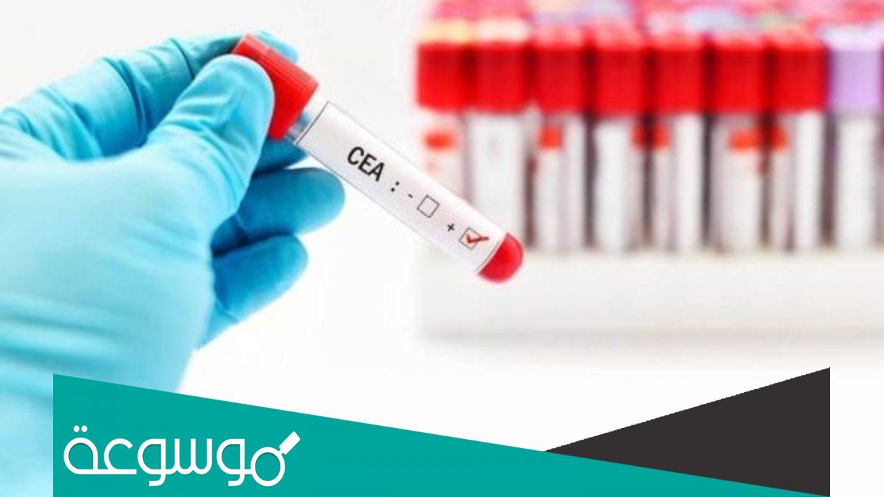 تحليل الدم الشامل ماذا يكشف