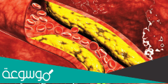 دواء بالأعشاب cholesterol لخفض الكوليسترول في الدم