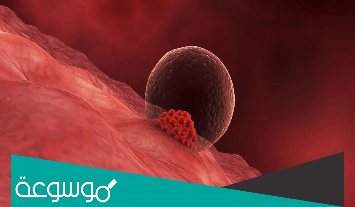 نزيف الحمل في الشهر الأول ما أسبابه وتأثيره