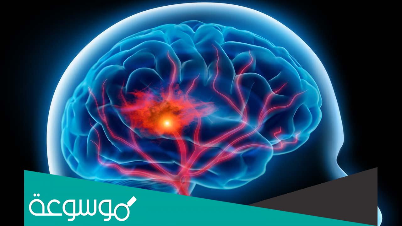 عملية سحب الماء من الراس وأهم التفاصيل عنها