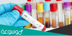 كم سعر تحليل الايدز في السعودية