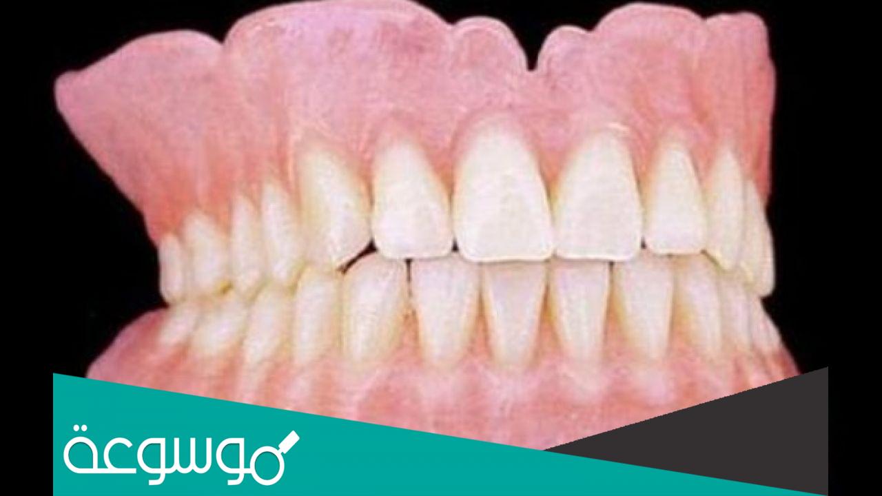 كم عدد اسنان الانسان البالغ مع اضراس العقل