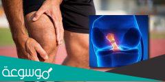 كم مدة علاج قطع غضروف الركبة بدون جراحة