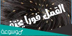 كيفية التخلص من القمل والصيبان من أول مرة
