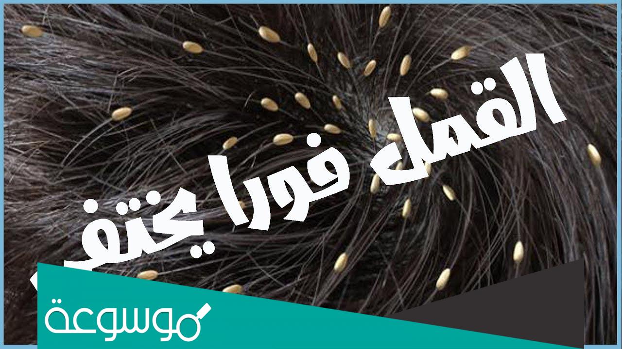 كيفية التخلص من القمل والصيبان من أول مرة