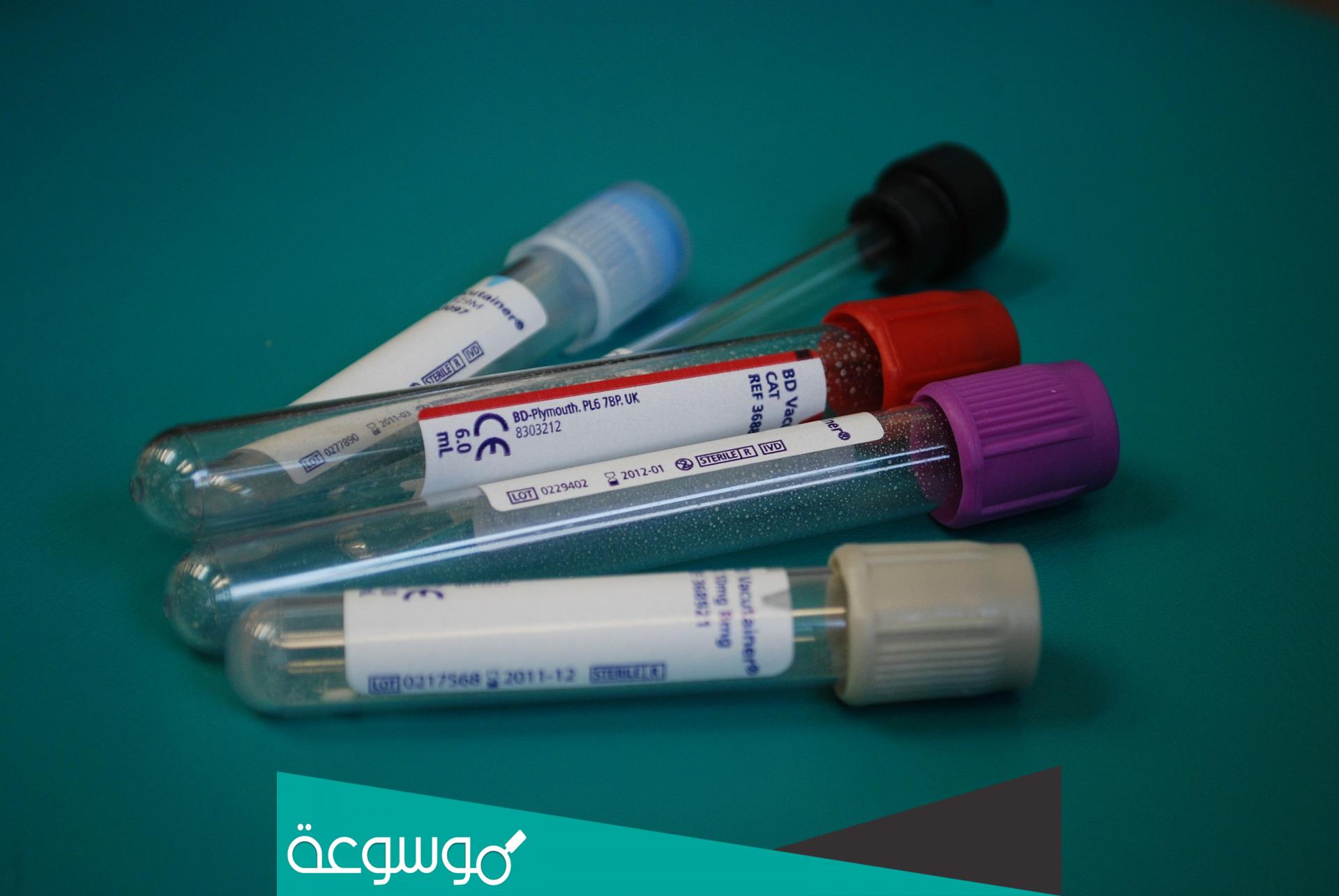 ما هو تحليل asot