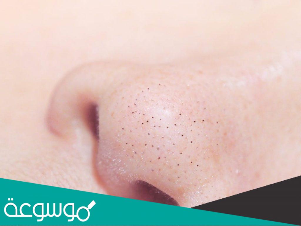 تفسير رؤية رأس سوداء على الأنف التفسير الصحيح