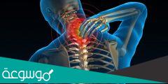 ما هي أعراض الانزلاق الغضروفي واسبابه وطرق علاجه