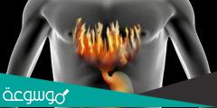 حرقان في المعدة الأسباب وافضل طرق العلاج منزليا