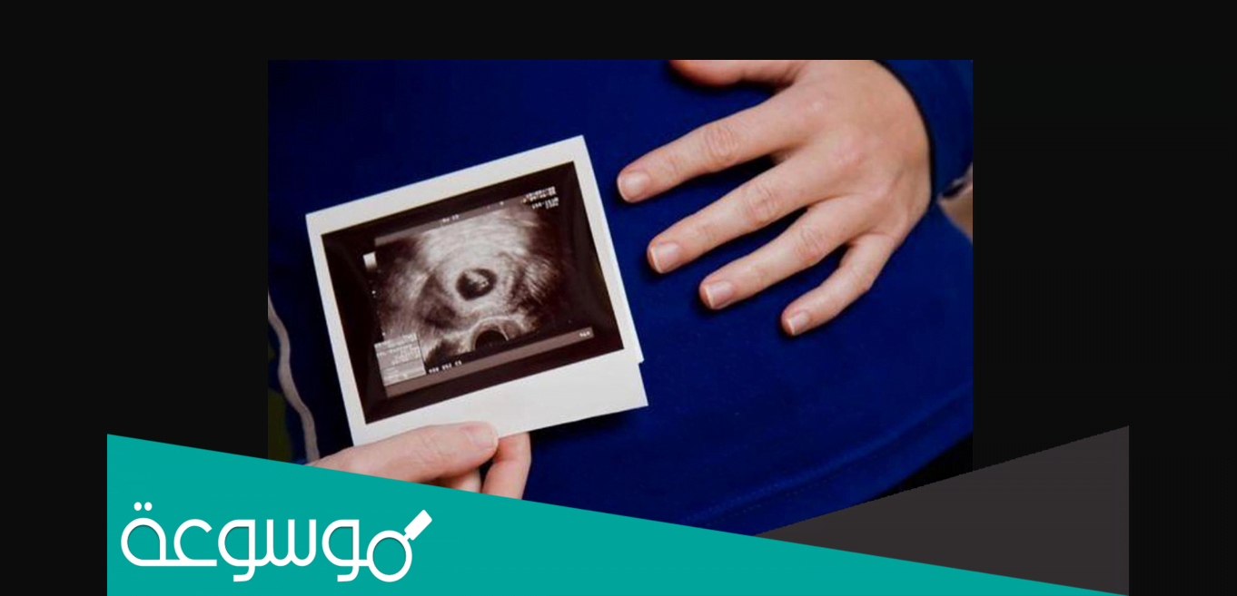 هل ممكن يتأخر ظهور الجنين في كيس الحمل؟